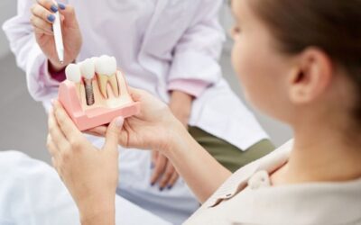 Fogászati implantátum: Minden, amit tudni érdemes róla